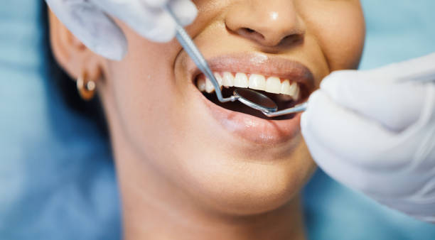 Best Emergency Dental Care for Broken or Chipped Teeth in Grant Valkaria, FL
